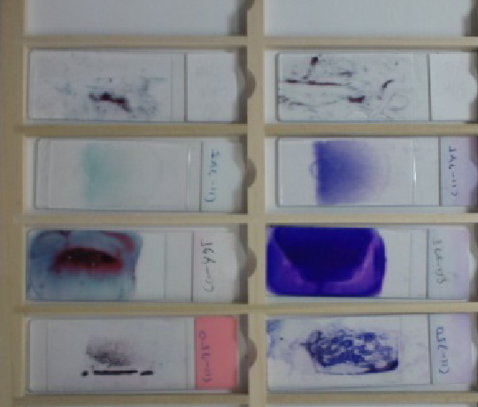 染色された細胞診標本の一例写真です。